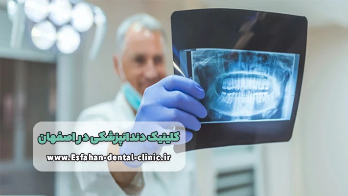 تصویربرداری دیجیتال در کلینیک دندانپزشکی اصفهان