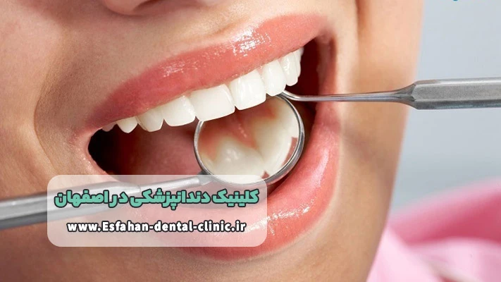 پیگیری و مراقبت پس از درمان در دندانپزشکی اصفهان