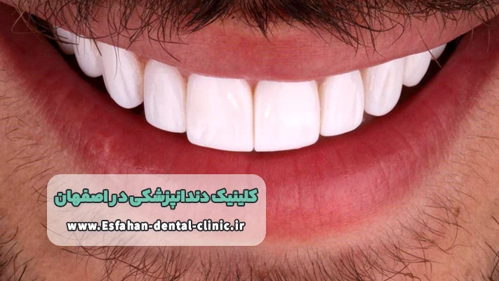 ترمیم زیبایی در کلینیک دندانپزشکی اصفهان
